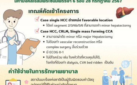 ประชาสัมพันธ์โครงการผ่าตัดมะเร็งตับผ่านกล้อง