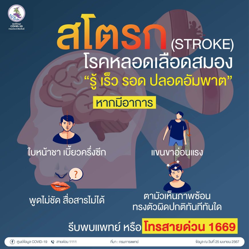 สโตรก (STROKE) โรคหลอดเลือดสมอง